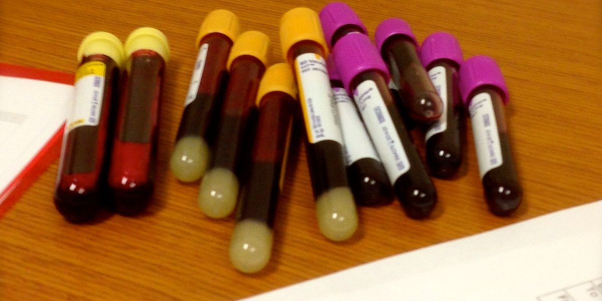 Understanding Cholesterol: The Basics Behind the Numbers